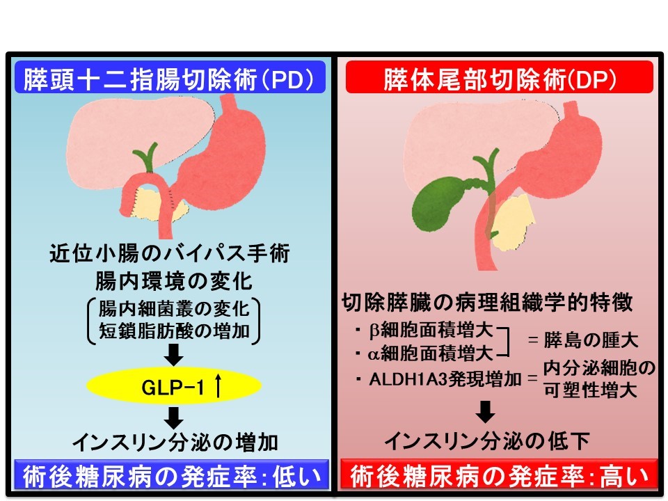 膵臓部分切除術後の糖尿病発症に関与する因子の解明