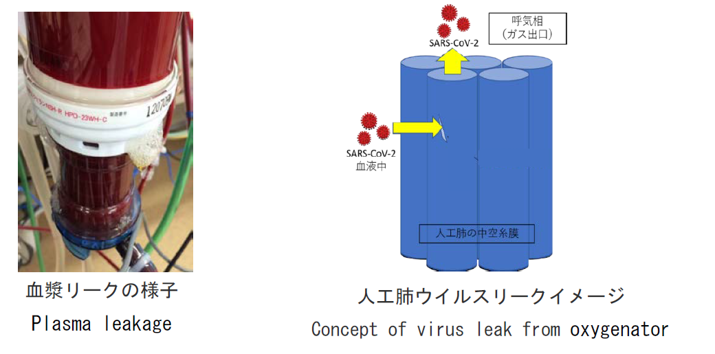 COVID-19患者のECMOでのウイルス漏出に対する安全性の向上