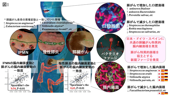 膵臓がんや予後と関連する口腔内細菌・腸内細菌種を発見